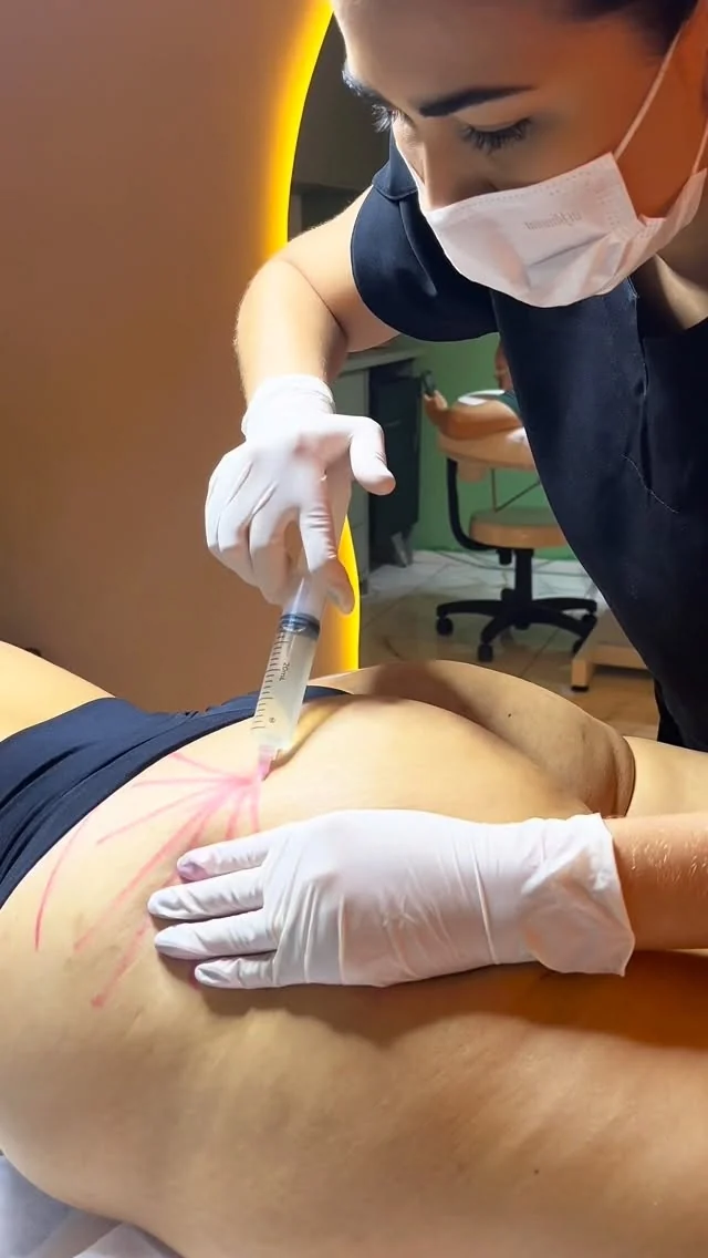 Procedimento corporal realizado pela Fabielly Toledo