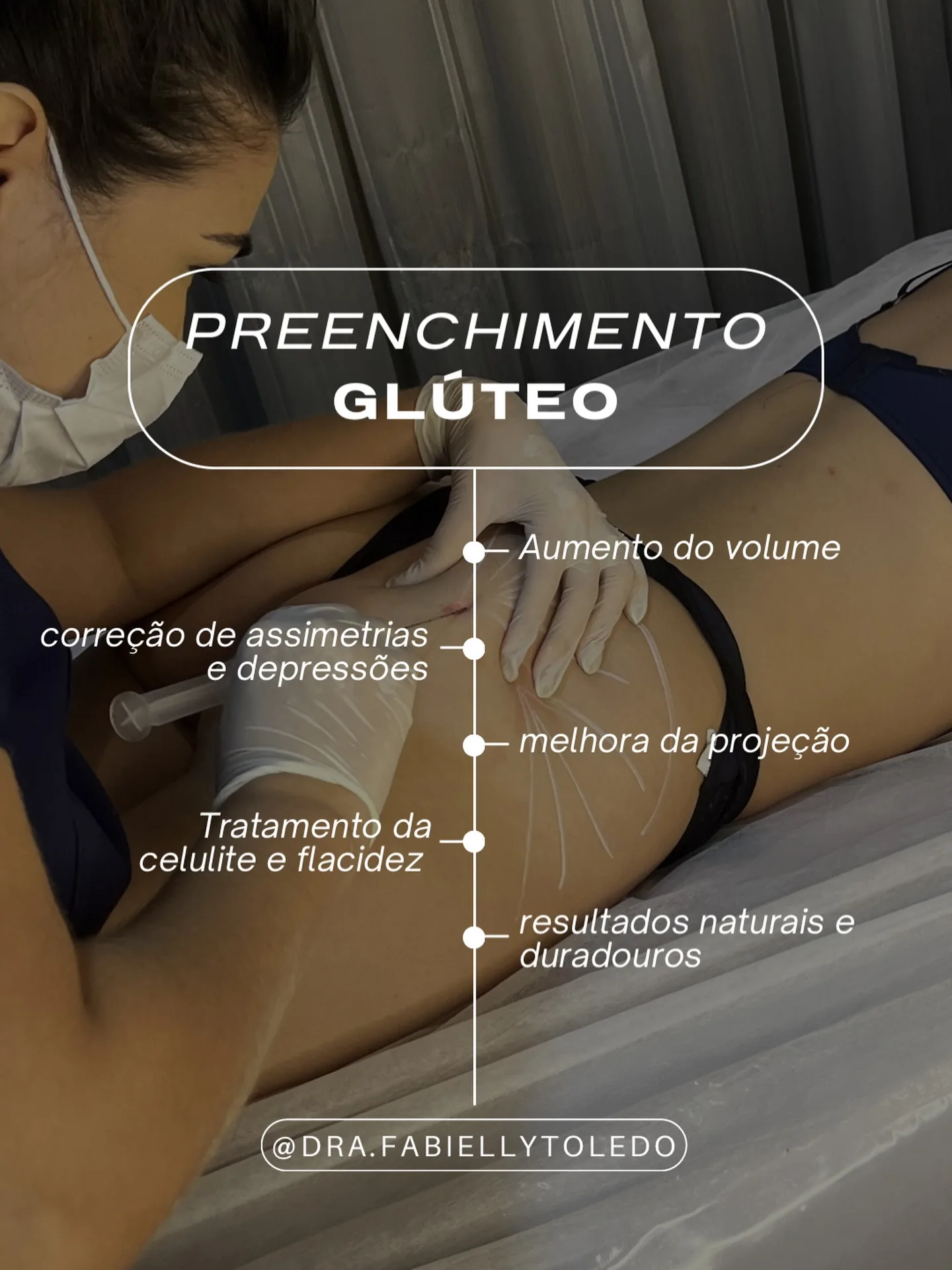 Preenchimento Glúteo: Preenchimento glúteo para mais volume e projeção, corrigindo assimetrias com resultado natural.